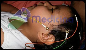 Electroencefalogramas en bebes en Guadalajara Jalisco Mexico