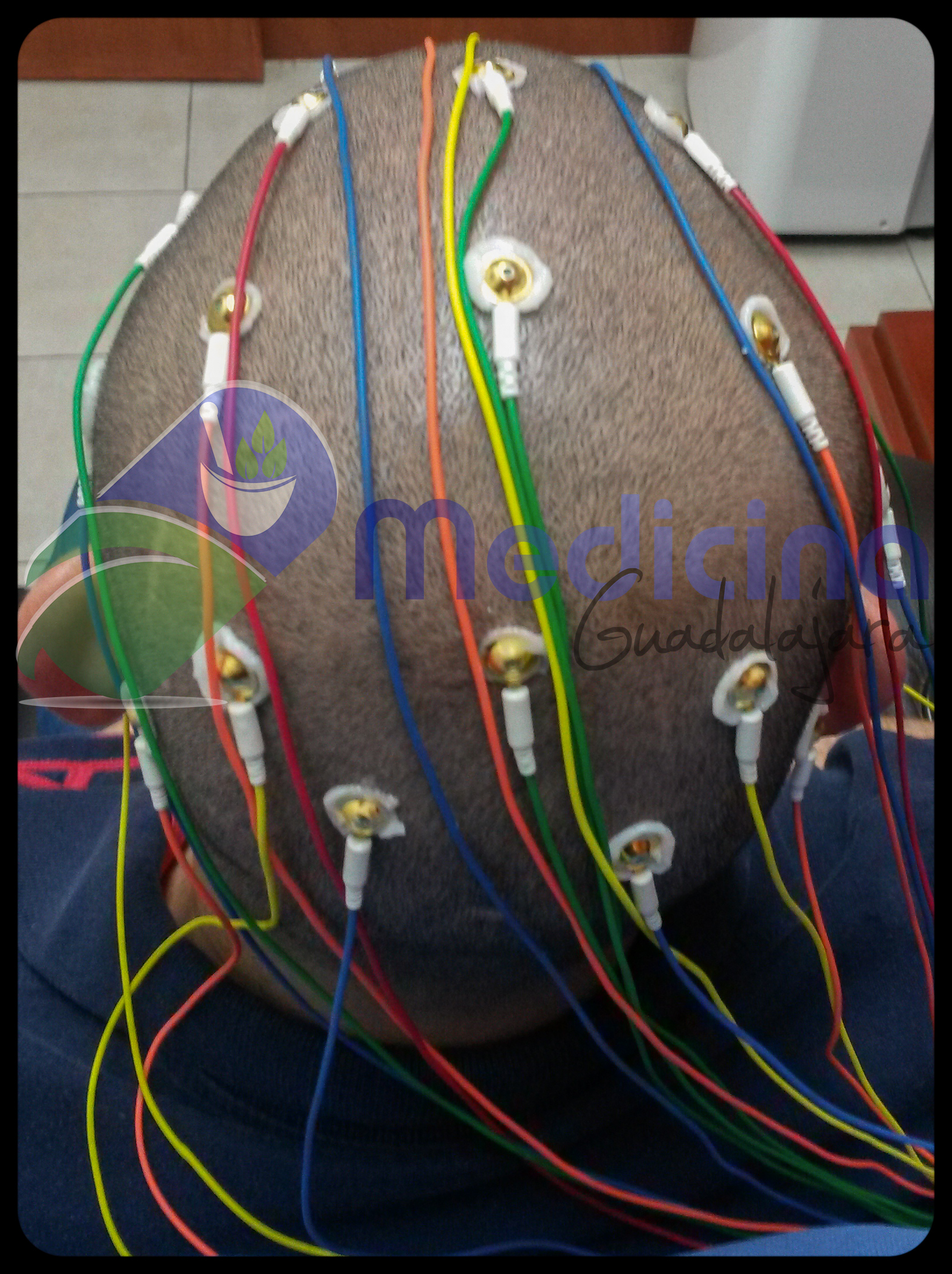 Electroencefalograma digital ADULTOS Medicina Guadalajara Jalisco
