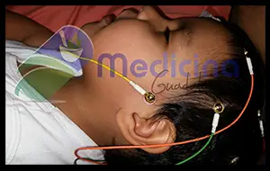 Electroencefalogramas en bebes en Guadalajara Jalisco Mexico