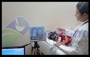 Video EEG en Guadalajara Jalisco Mexico